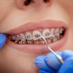 A Plus Dentistry
