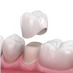 Dental-crowns